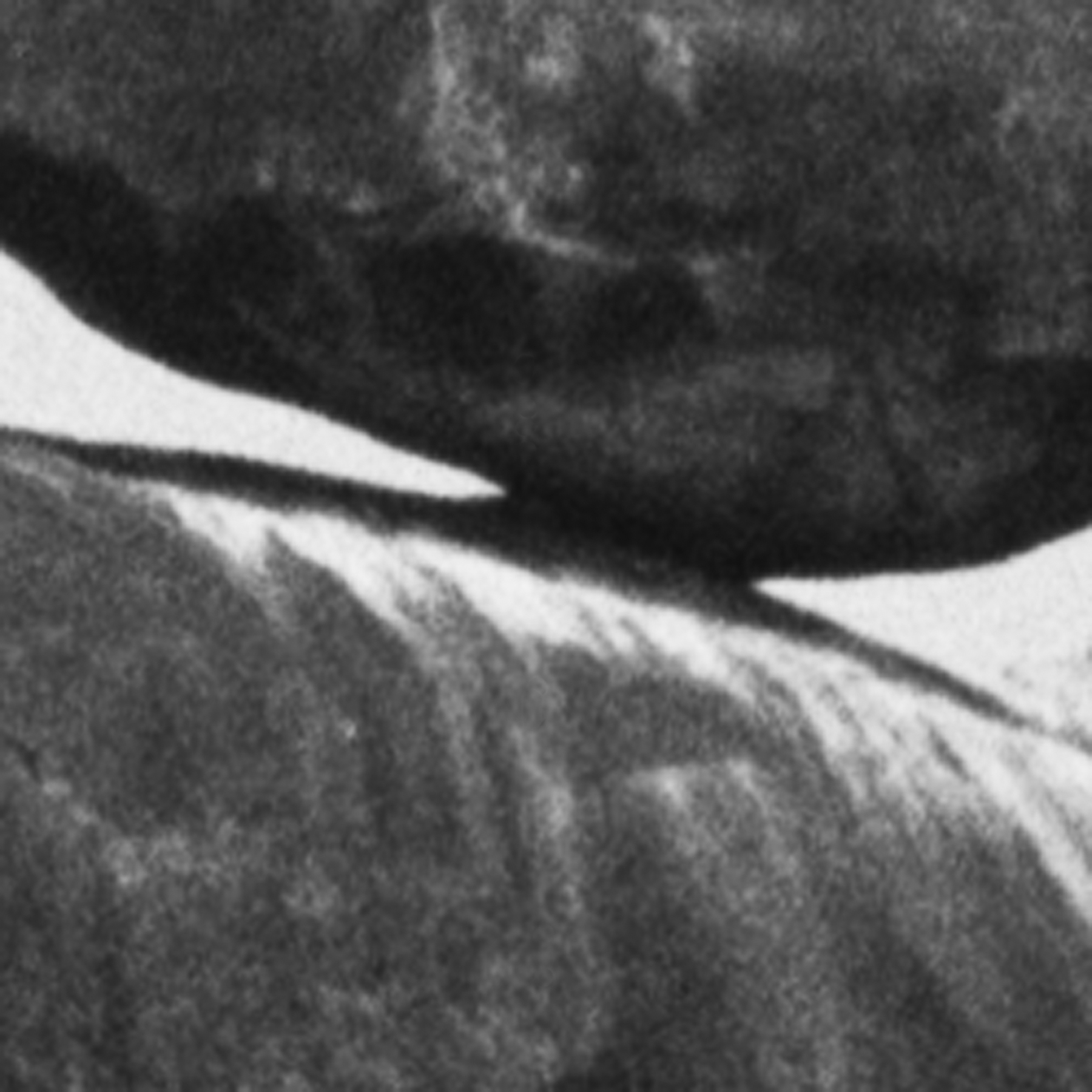 louisebogelundsaugmann - 