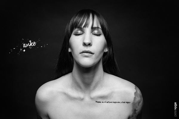 petervyge - Anke