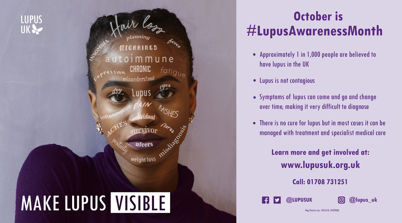Emily Mead - Lupus UK Awareness Month Campaign
